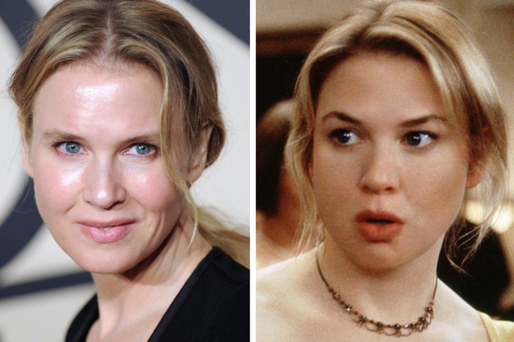 Renée Zellweger, Plastic Surgery, & Loving My Aging Skin ...